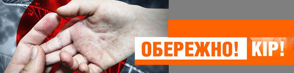 oberegnphcd7bg